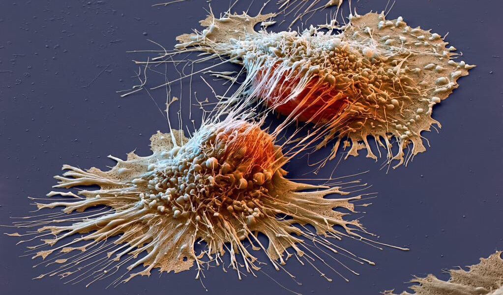 Todos tenemos celulas cancerígenas